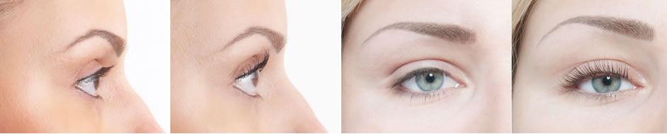 LVL Before and after